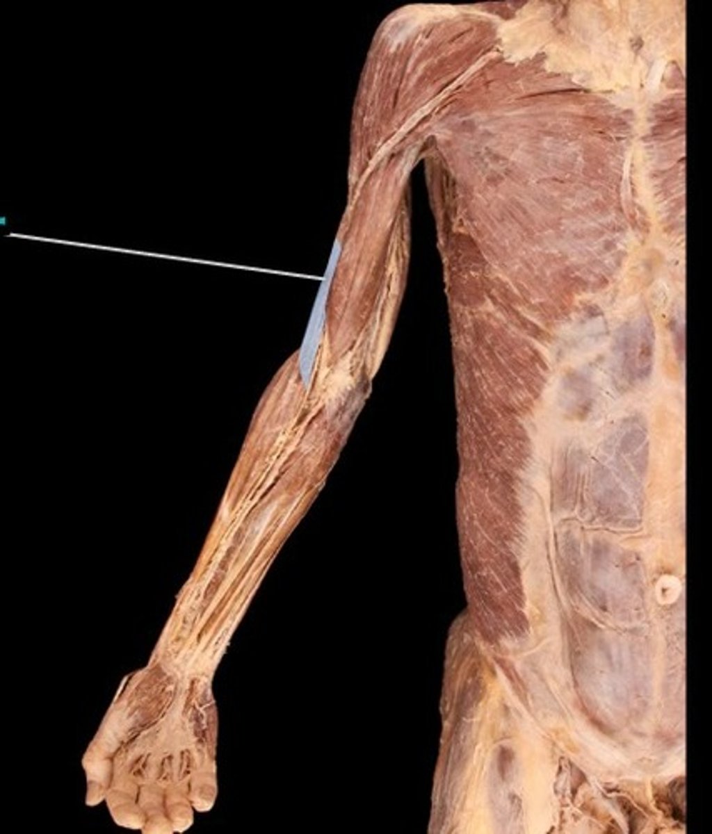 <p>What muscle is this?</p>