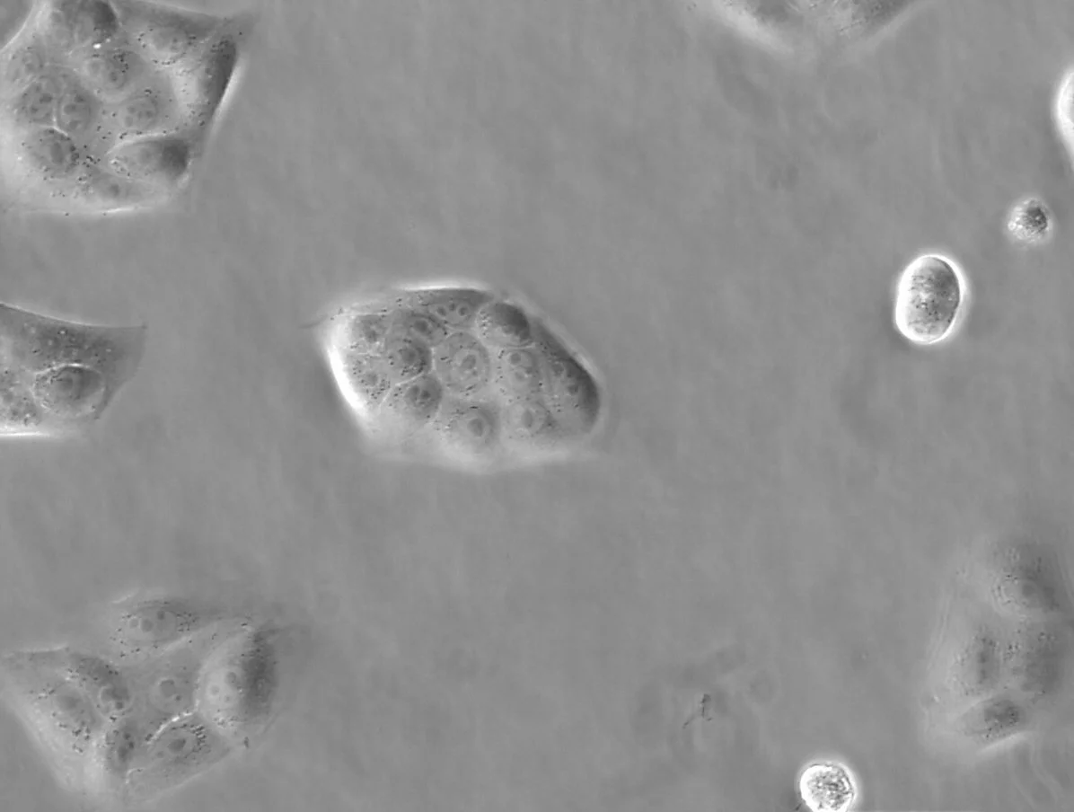 <p>Type of electron microscope, converts phase shifts in light passing through a transparent specimen to brightness changes in the image.</p>