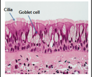 <ul><li><p>structure: all cells touch basement membrane but not all reach the free surface</p></li><li><p>location: respiratory tract, male urethra</p></li><li><p>function: specialized goblet cells release mucous that coat passageways (is able to expand)</p></li></ul>