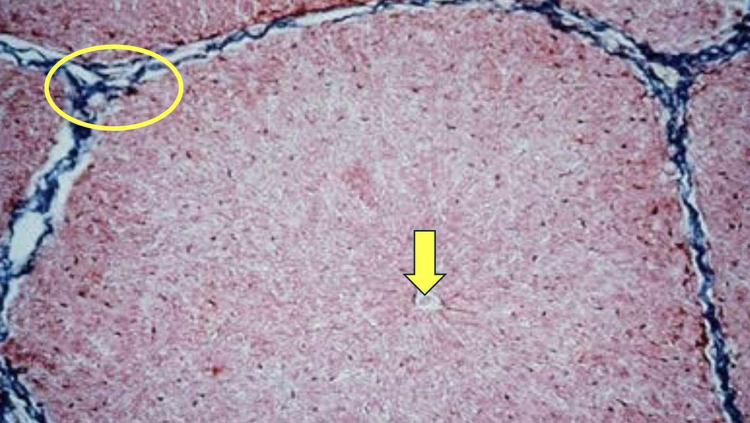 <p>What is the yellow arrow pointing to?</p>