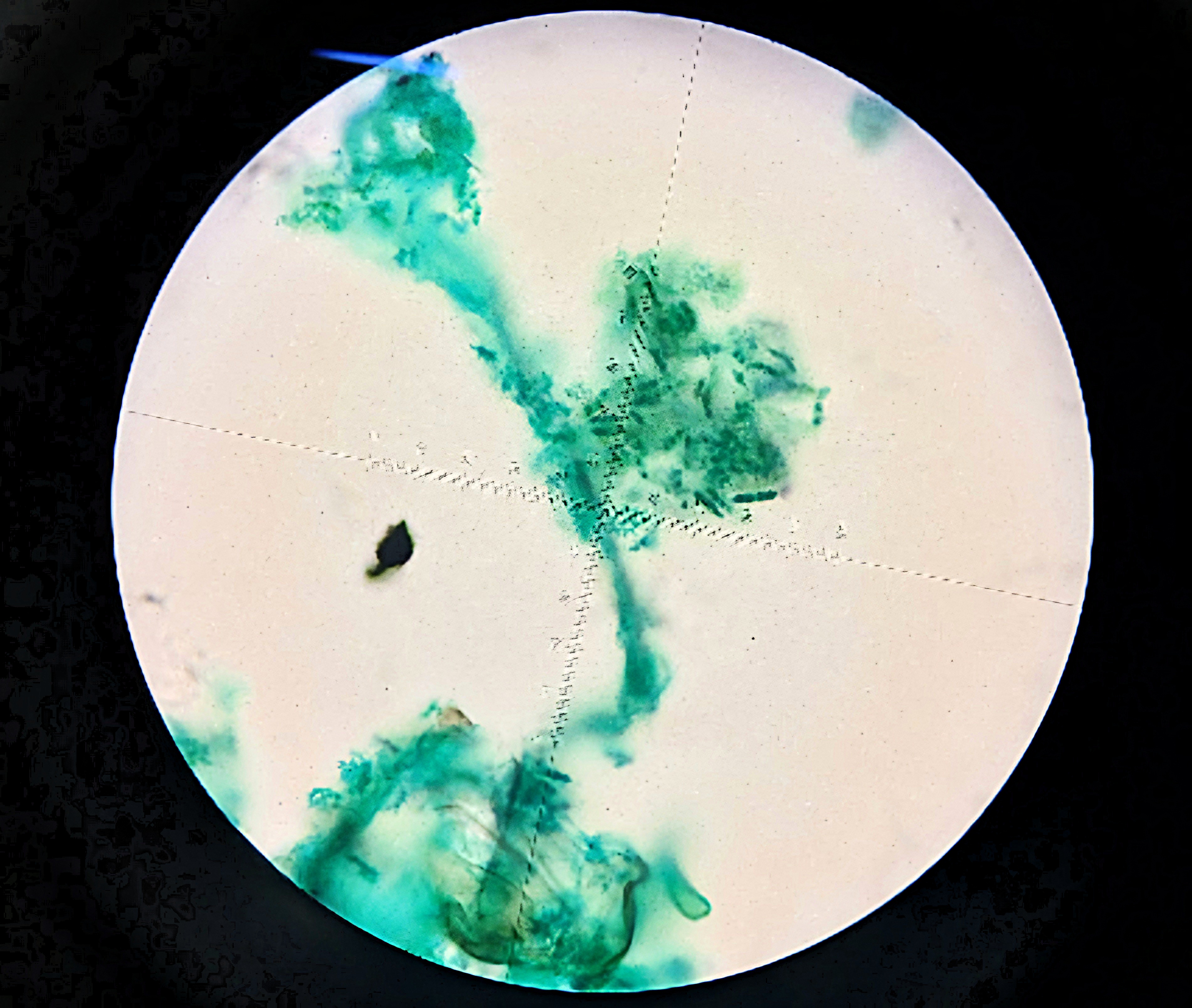 <p>Phylum: Chlorophyta</p><p>Ecological Importance:</p><ul><li><p>contributes significantly to primary production in freshwater environments.</p></li><li><p>produces oxygen, which is essential for the survival of aerobic organisms in aquatic ecosystems</p></li><li><p>plays a role in nutrient cycling by absorbing nutrients like nitrogen and phosphorus from the water.</p></li></ul><p>Economical Importance: </p><ul><li><p>has potential in biofuel production. Its high lipid content makes it suitable for producing biodiesel.</p></li><li><p>used as a feed for aquaculture, particularly for fish and crustaceans, due to its high nutritional value.</p></li><li><p>has applications in bioremediation by helping to clean up wastewater</p></li></ul><p></p>