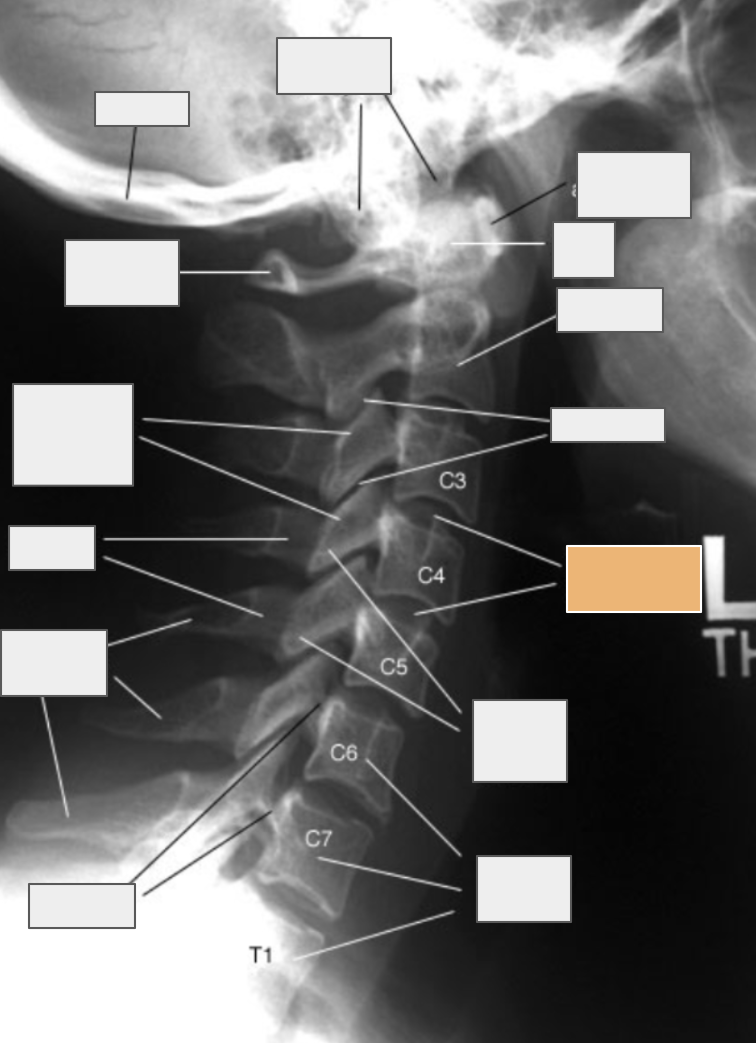 <p>What structure of the spine does the box highlighted in orange reference to?</p>