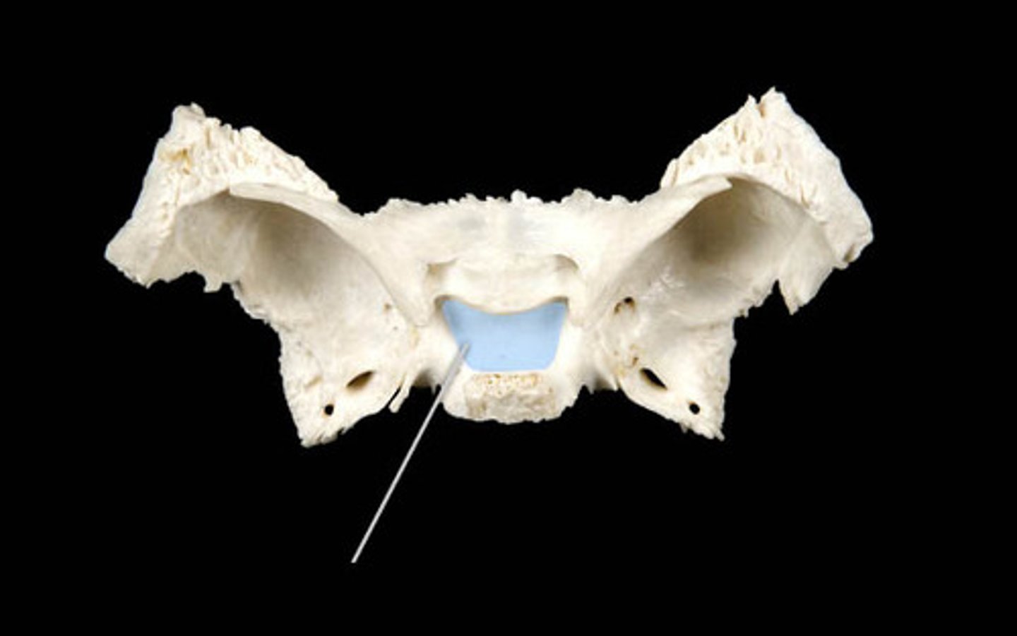 <p>Label the sphenoid bone</p>