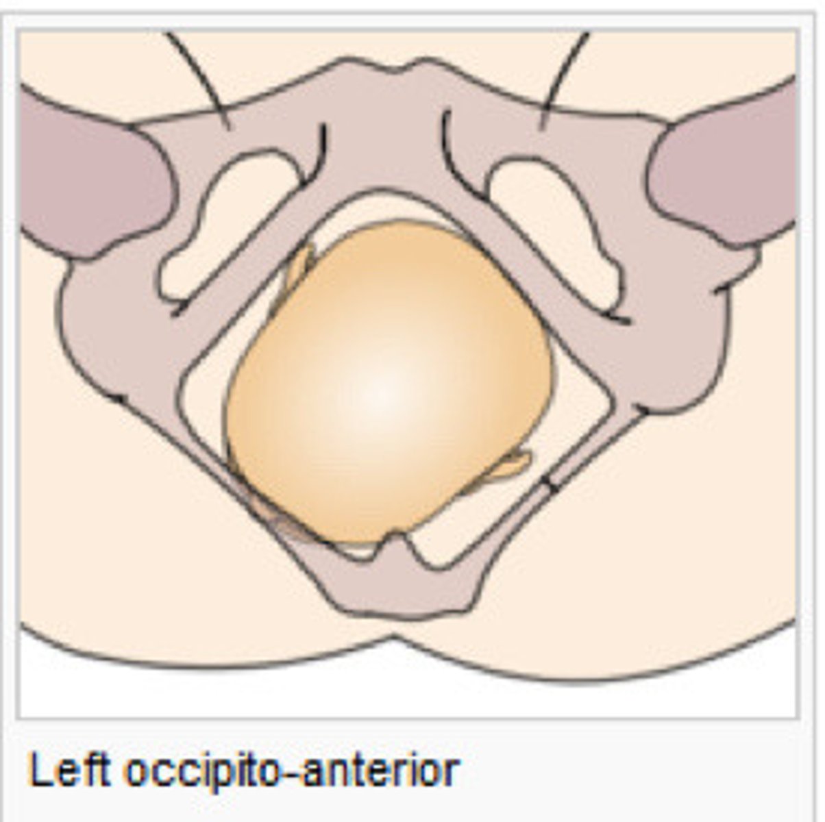 <p>Left occipital anterior (LOA) vertex</p><p>(Baby is looking down to the right)</p>