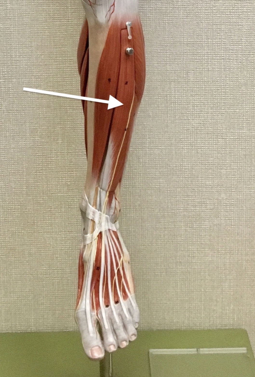 <p><span>Name the muscle labeled with the white arrow below:</span></p>