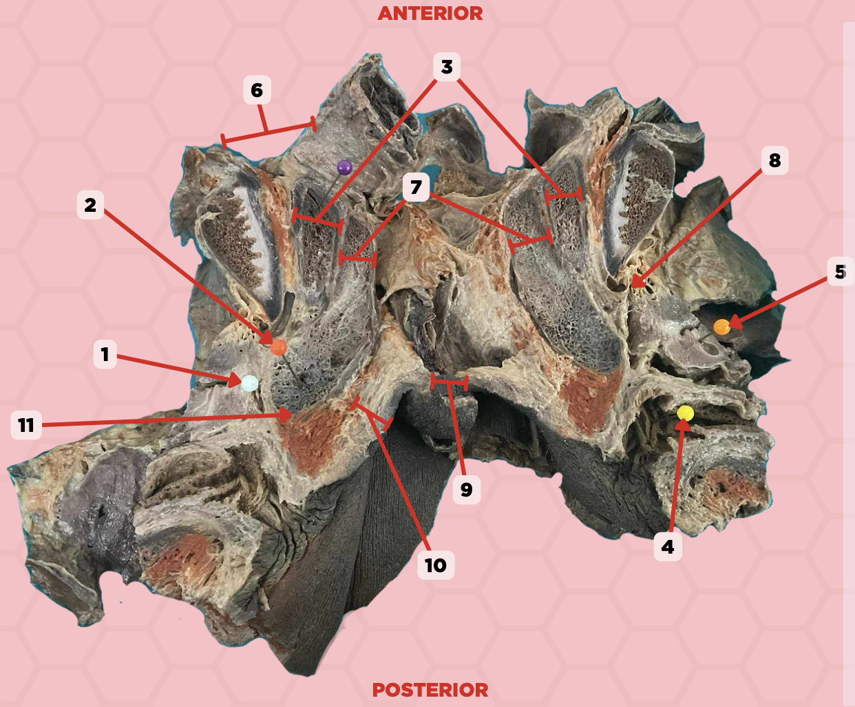<p>Identify the structure labeled as 17.</p>