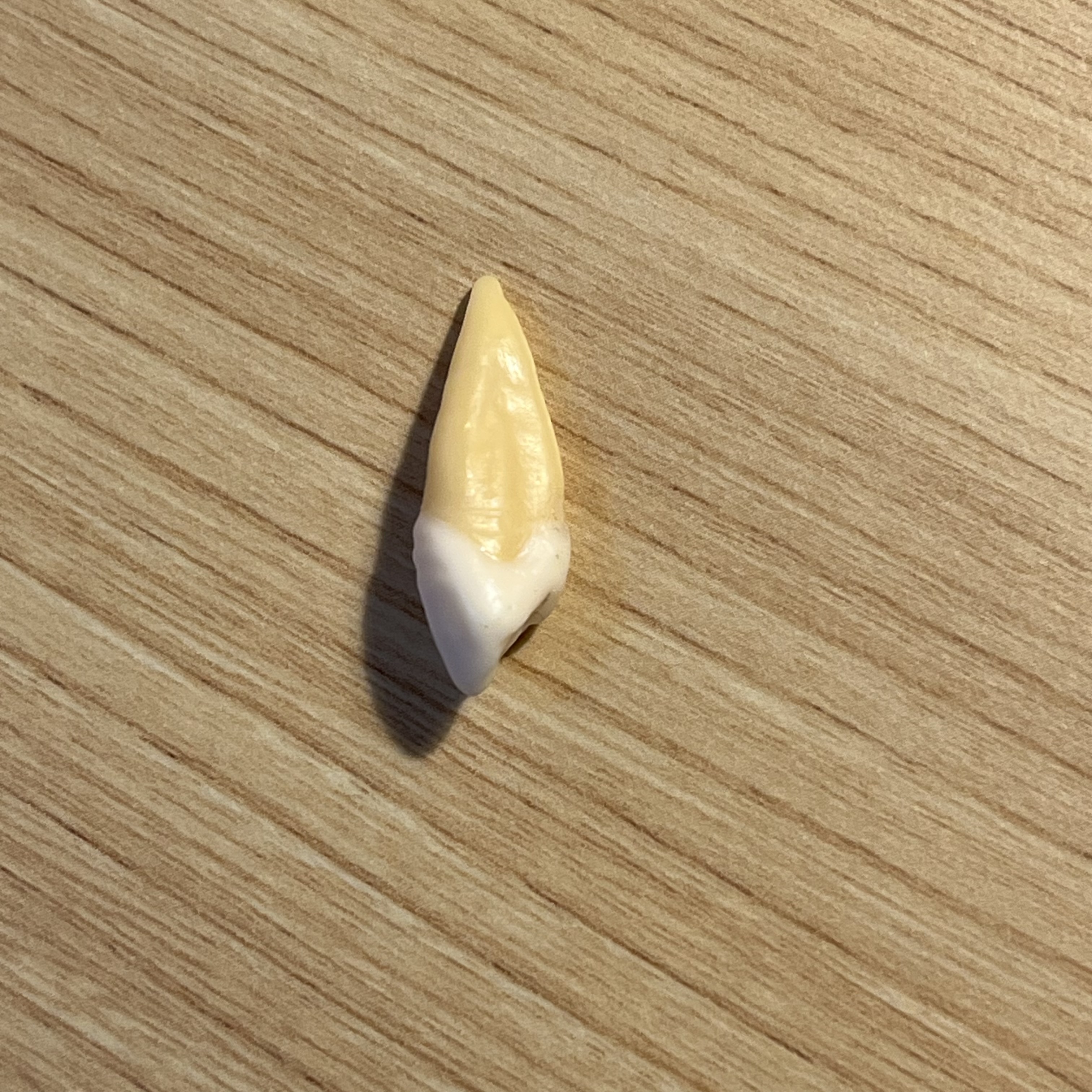 <p>What tooth is this (with view)?</p>