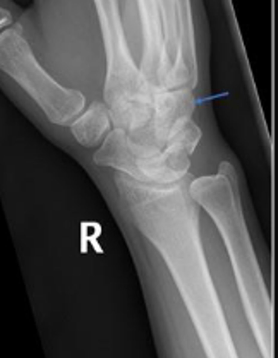 <p>What is outlined?</p>