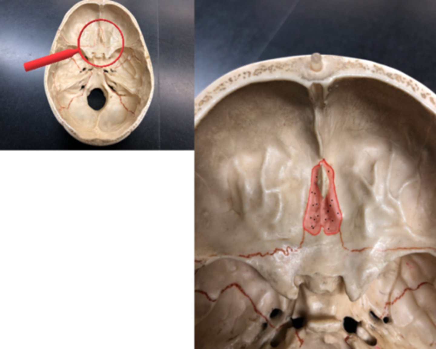 <p>The colored structure that includes the olfactory foramina.</p>