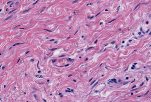 <p>Dense irregular connective tissue</p>