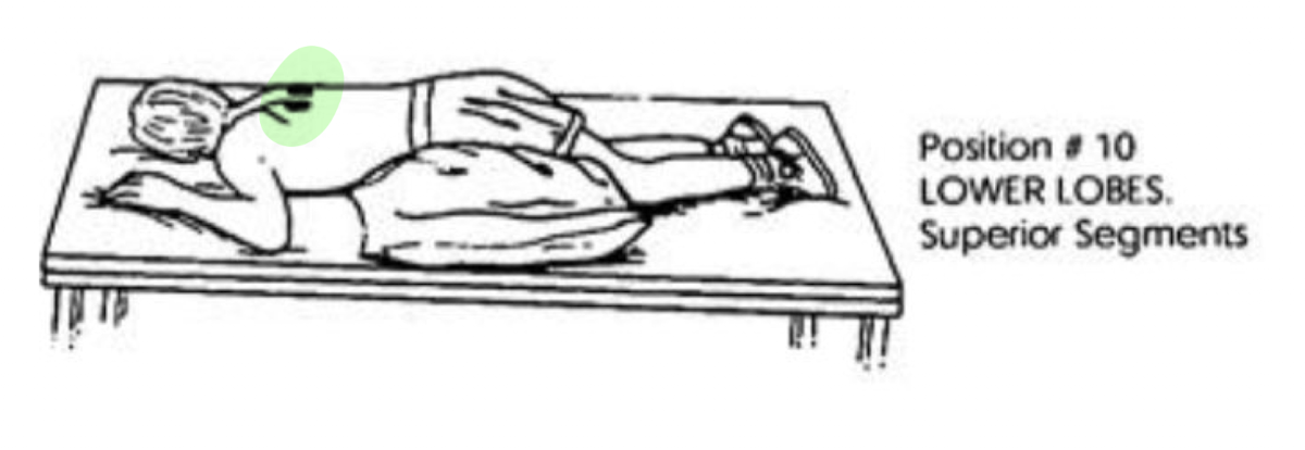 <ul><li><p>Prone with the Table Level </p></li></ul><p></p>