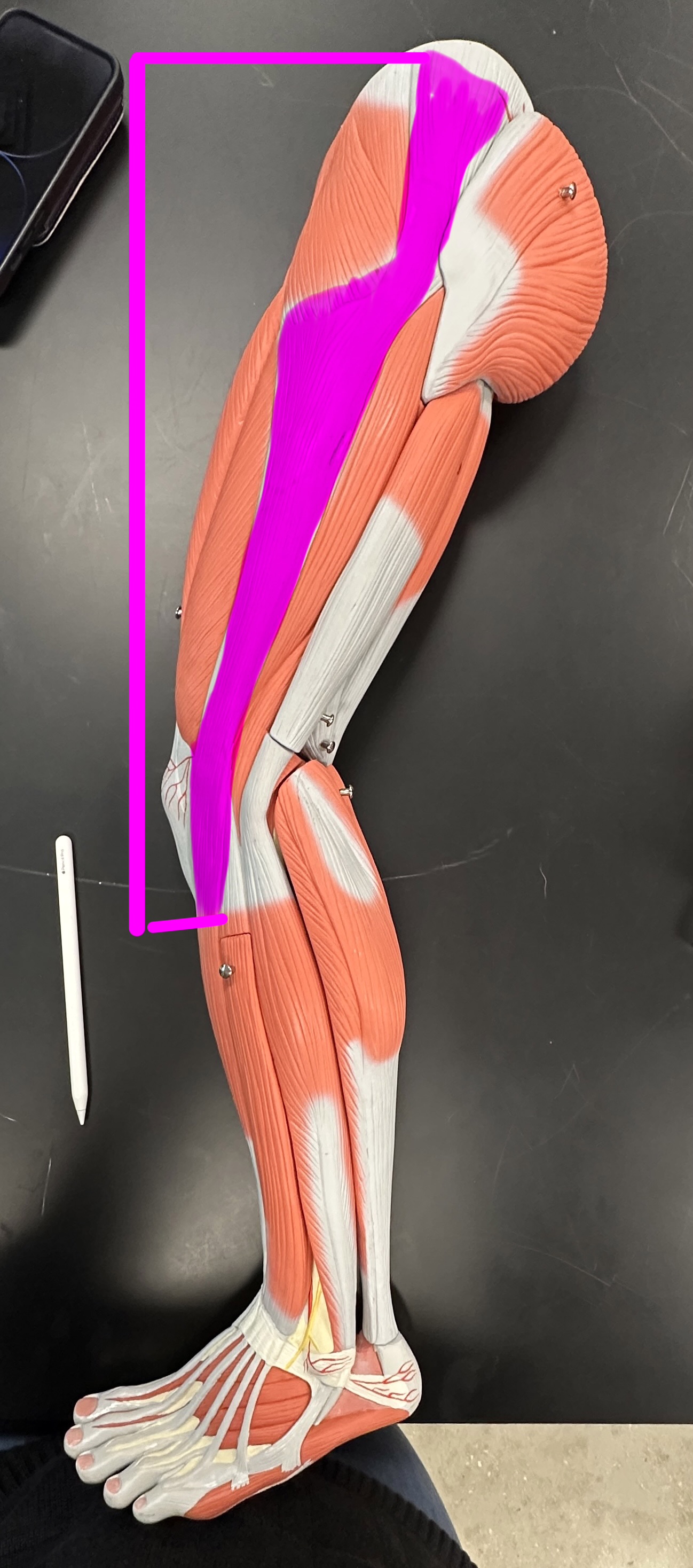 <p>What is the highlighted structure</p>