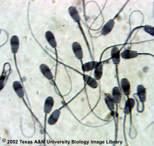 Darker sperm are carrying an X chromosome, lighter sperm are carrying a Y chromosome - used to sex semen