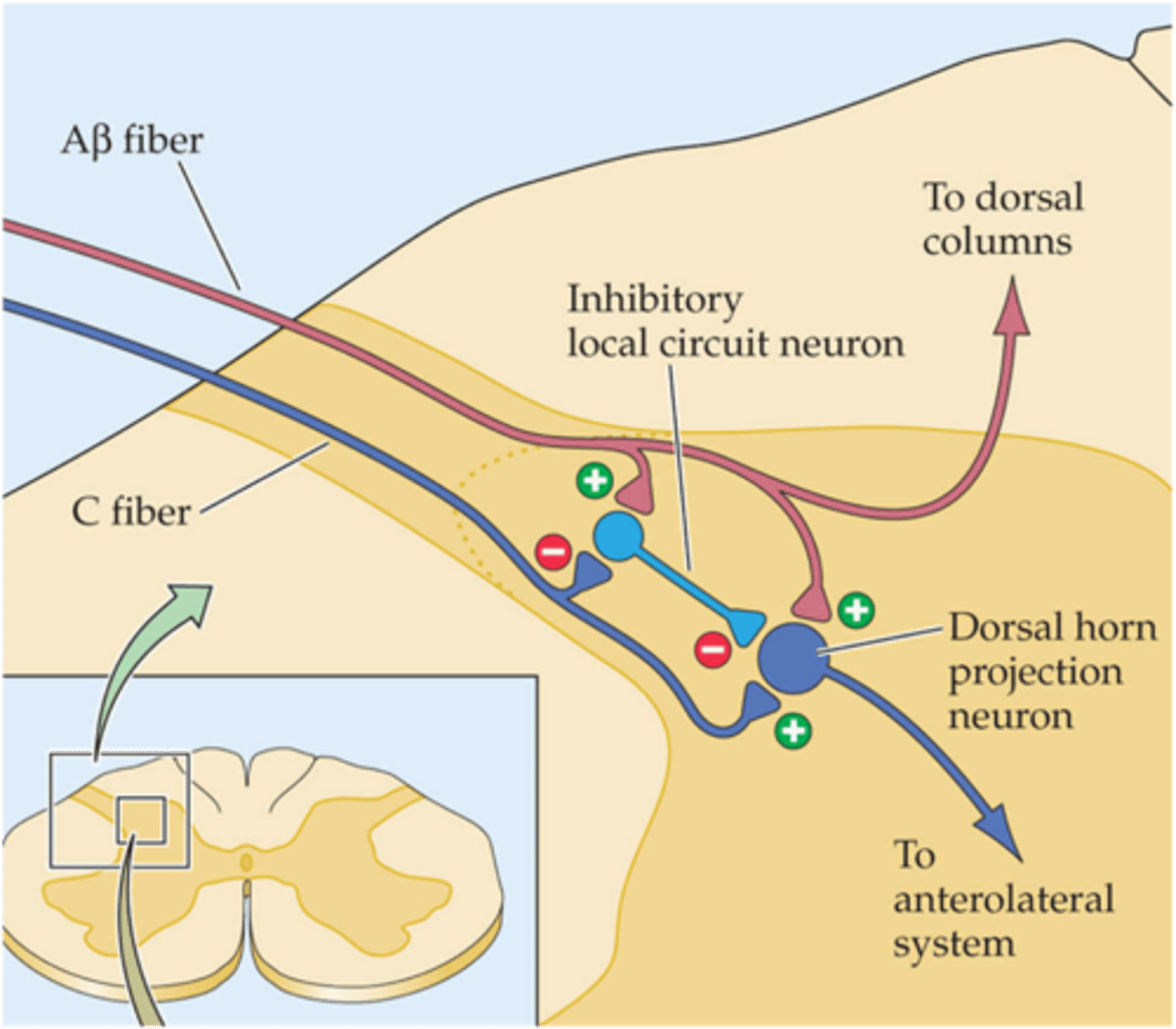 <p>Rubbing an injury often relieves the pain - this is thought to be due to ________ ______________ by mechanoceptors (__ fibres) of nociceptive (_ fibre) inputs in the spinal cord</p>