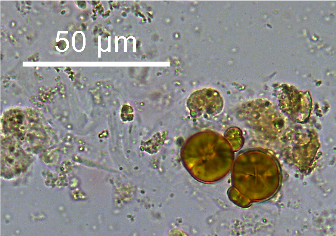 <p>yellow spheres with rings</p>