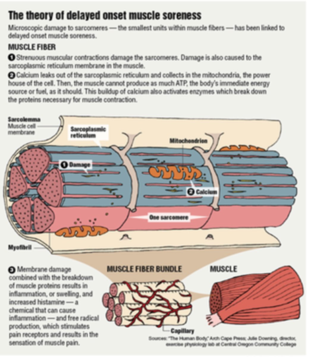<p>DOMS (delayed onset muscle soreness)</p>