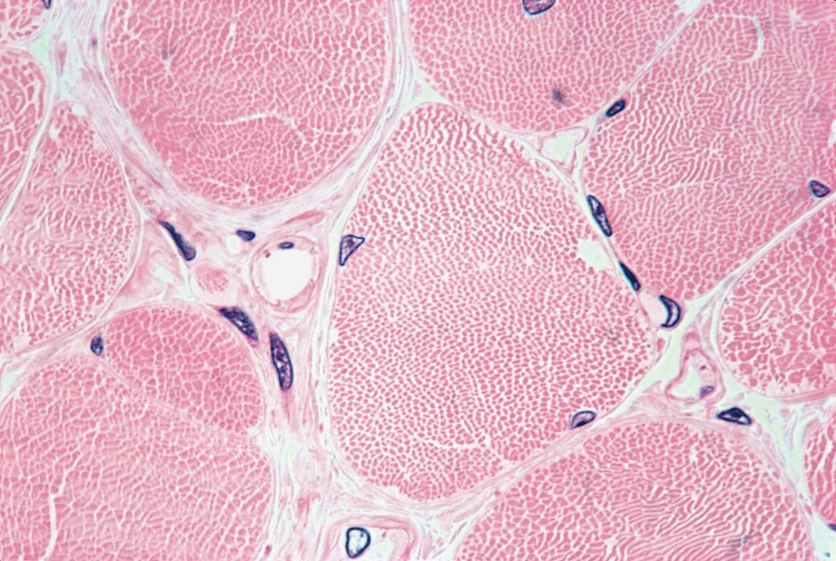 <p>Skeletal Muscle</p>