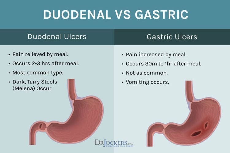 <p>A sore on the lining of your stomach, small intestine, or esophagus. Main symptom is abdominal pain, it varies in place from person to person </p>