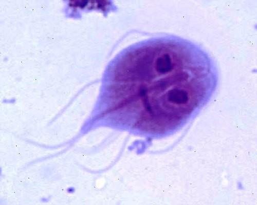 <p>What is this protist?</p>