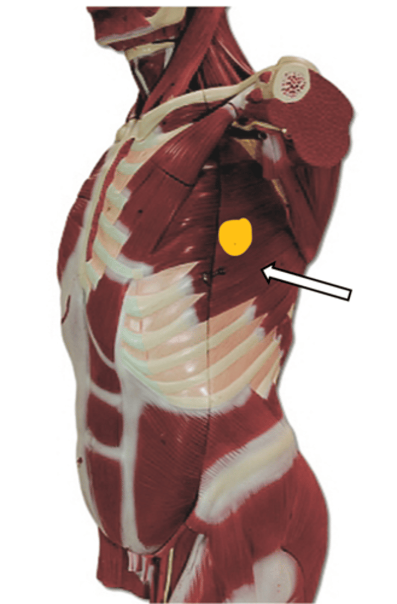 <p>name the muscle</p>