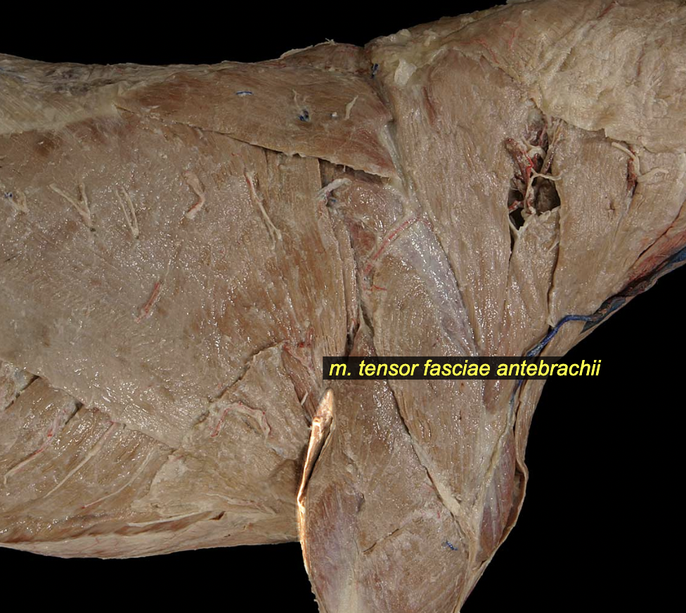 <p><span>O: fascia of lateral </span><em>m. latissimus dorsi</em><br><span>I: olecranon</span><br><span>A: elbow extension</span><br><span>N: radial n.</span></p>