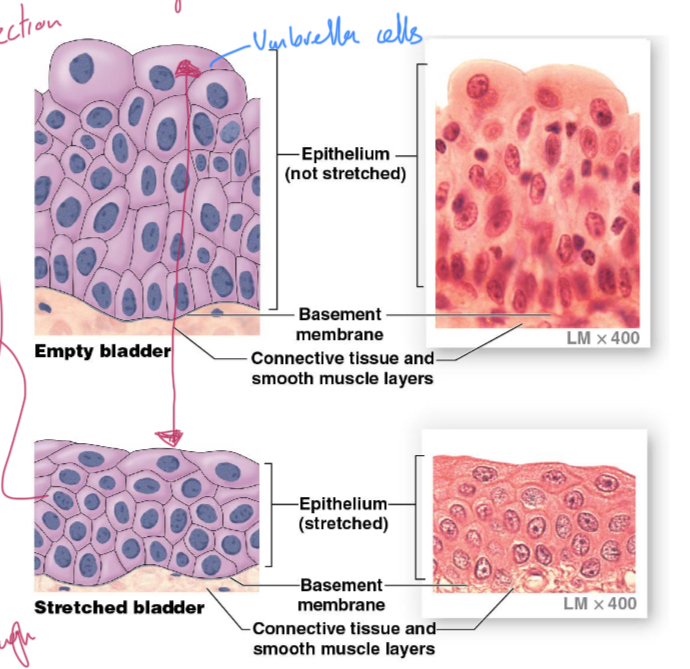 <p>Stratified, rounded cells that flatten when stretched, used for protection.</p>