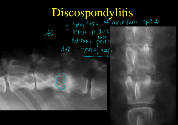 <ul><li><p><strong>Thoracic and lumbar spine</strong> are the<strong><u> most common</u></strong> sites</p></li><li><p><strong>Cause</strong></p><ul><li><p><strong>Bacti infection</strong> of <strong>discs and end plates</strong></p><ul><li><p>staph, strep, e coli, brucella</p></li><li><p>Hematogenous infections</p></li><li><p>can be secondary</p><ul><li><p>septic emboli</p></li></ul></li></ul></li><li><p><strong>GSD, Danes, Males</strong></p></li></ul></li><li><p><strong>CS</strong></p><ul><li><p><strong><u>Young</u></strong><u>,</u><strong><u> focal</u></strong> <strong><u>back pain</u></strong>, reluctance to move or ambulate, neuro deficits to limbs, bony lysis</p></li></ul></li><li><p><strong>Views</strong></p><ul><li><p>Lateral and VD of entire spine</p></li></ul></li><li><p><strong>RS</strong></p><ul><li><p><strong><u>Osteolytic</u></strong> focal lesion, wide/narrow <strong><u>intervertebral disc space</u></strong></p></li></ul></li></ul><p></p>