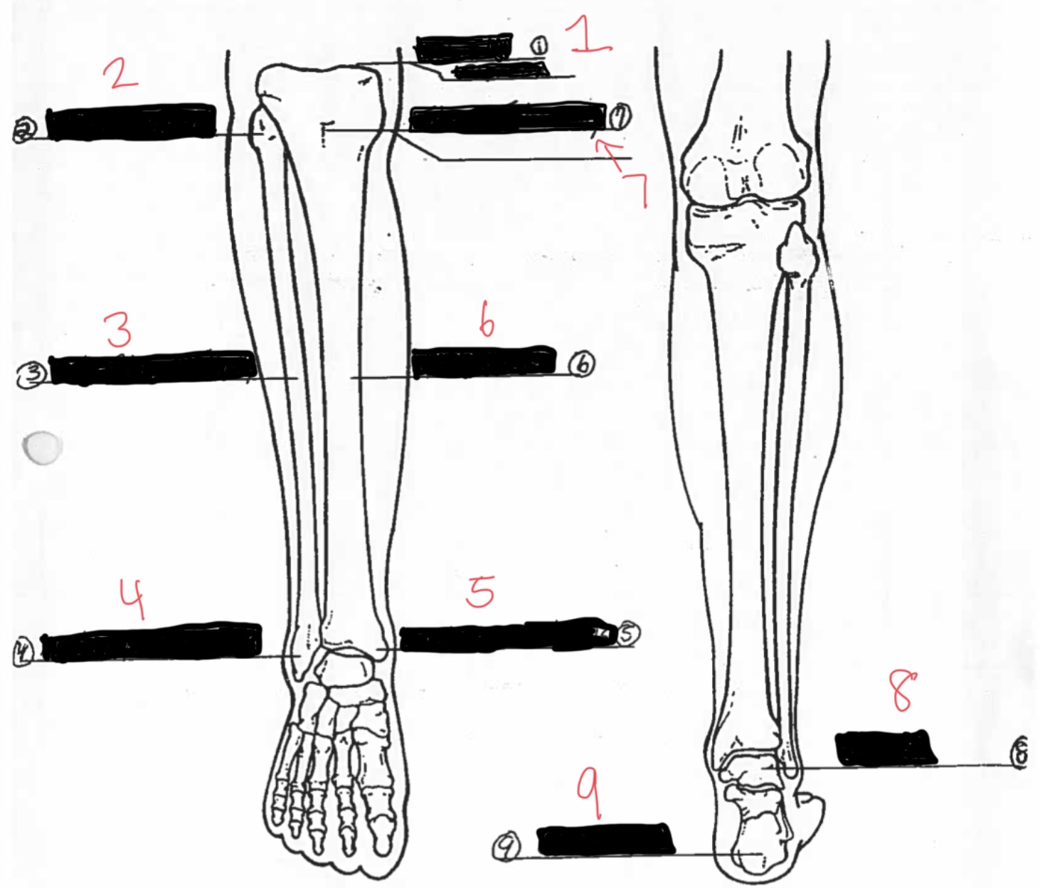 <ol><li><p>Tibial Plateau</p></li><li><p>Fibula Heads</p></li><li><p>Shaft of Fibula</p></li><li><p>Lateral Malleolus</p></li><li><p>Medial Malleolus</p></li><li><p>Tibial Shaft</p></li><li><p>Tibial Tuberosity</p></li><li><p>Talus</p></li><li><p>Calcaneus</p></li></ol><p></p>