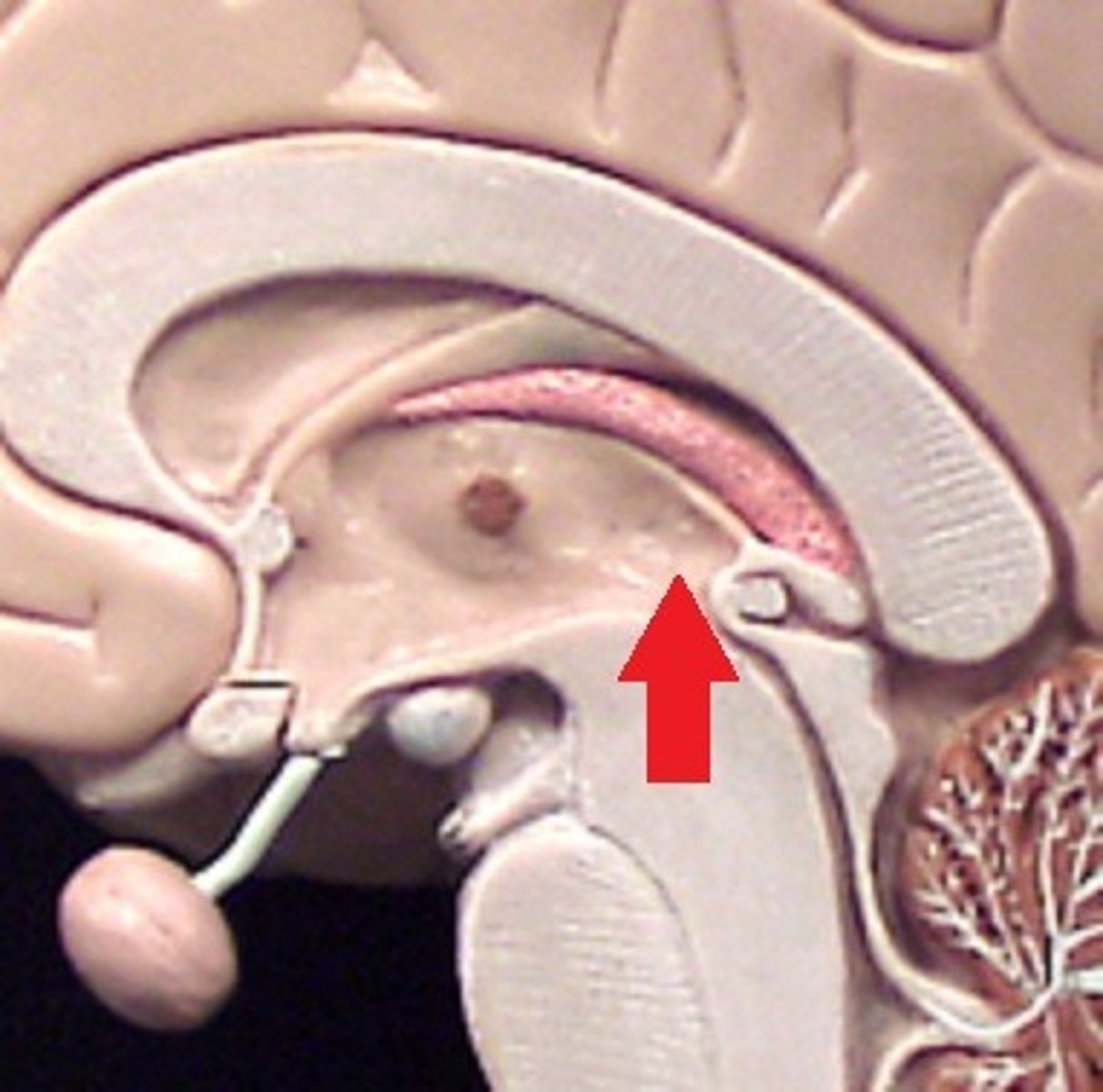 <p>name this part of the inner brain</p>