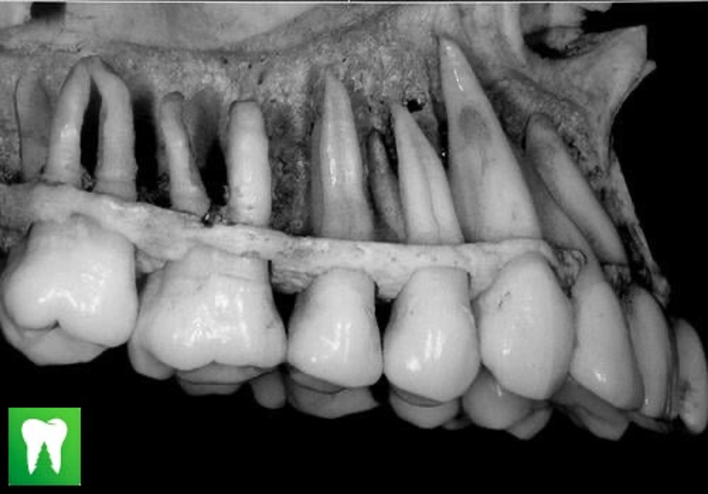 <p>Anterior teeth and premolars normally have single roots. </p><p>An EXCEPTION is the ____ ____ ____ which normally has 2 roots: B &amp; L root branches </p>
