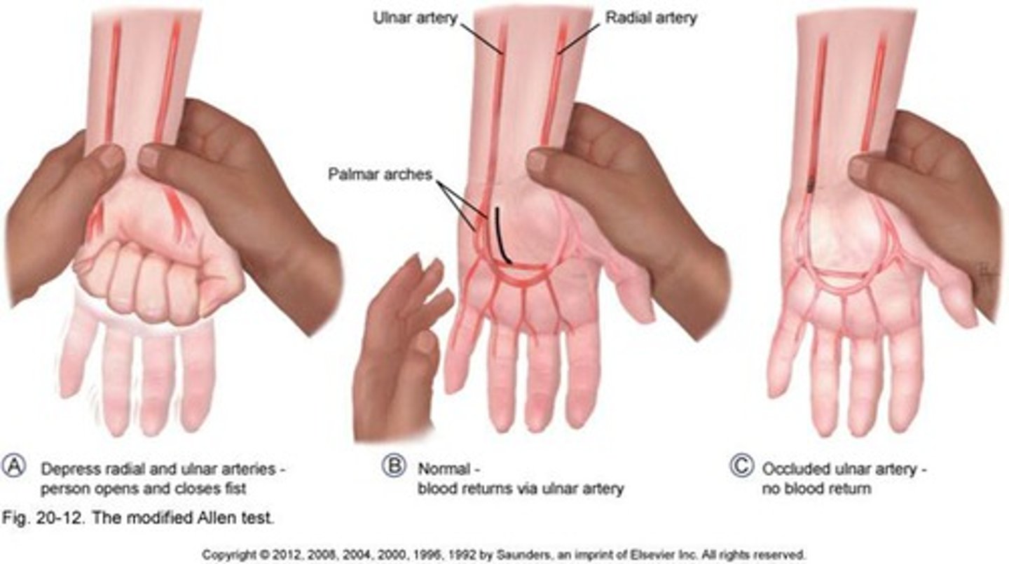 <p>Patient is seated with their elbow flexed and forearm supinated. Ask patient to pump their hand while doctor occludes the radial and ulnar arteries until hand whitens. The patient the opens hand and doctor releases on artery, recording fill time (until hand regains color). Repeat for other artery.</p><p>Postive for delay more than 10 seconds -> occlusion of the tested artery</p>