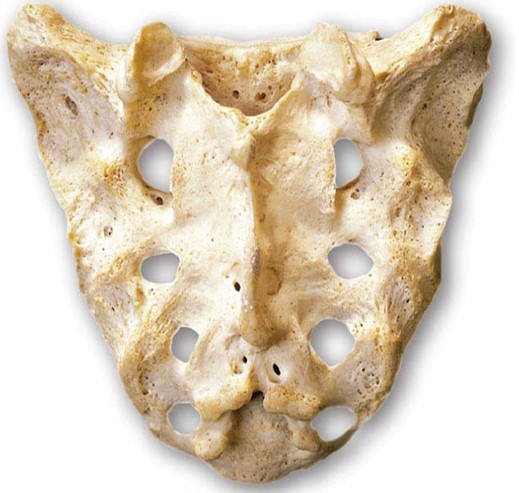 <p>The sacrum is comprised of five vertebrae that fuse during development (by the age of 25-30). Sacral crests form during fusion.</p>