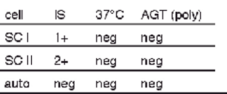 <p>antibody screen results + possible interpretations:</p><ul><li><p>1+ at IS with SCI</p></li><li><p>2+ at IS with SCII</p></li></ul><p></p>