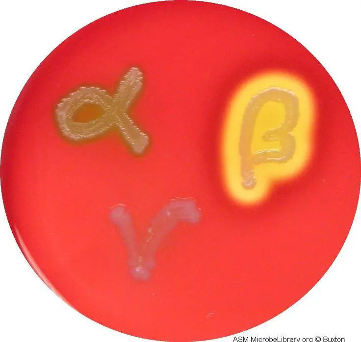 <p>Gamma hemolysis</p>