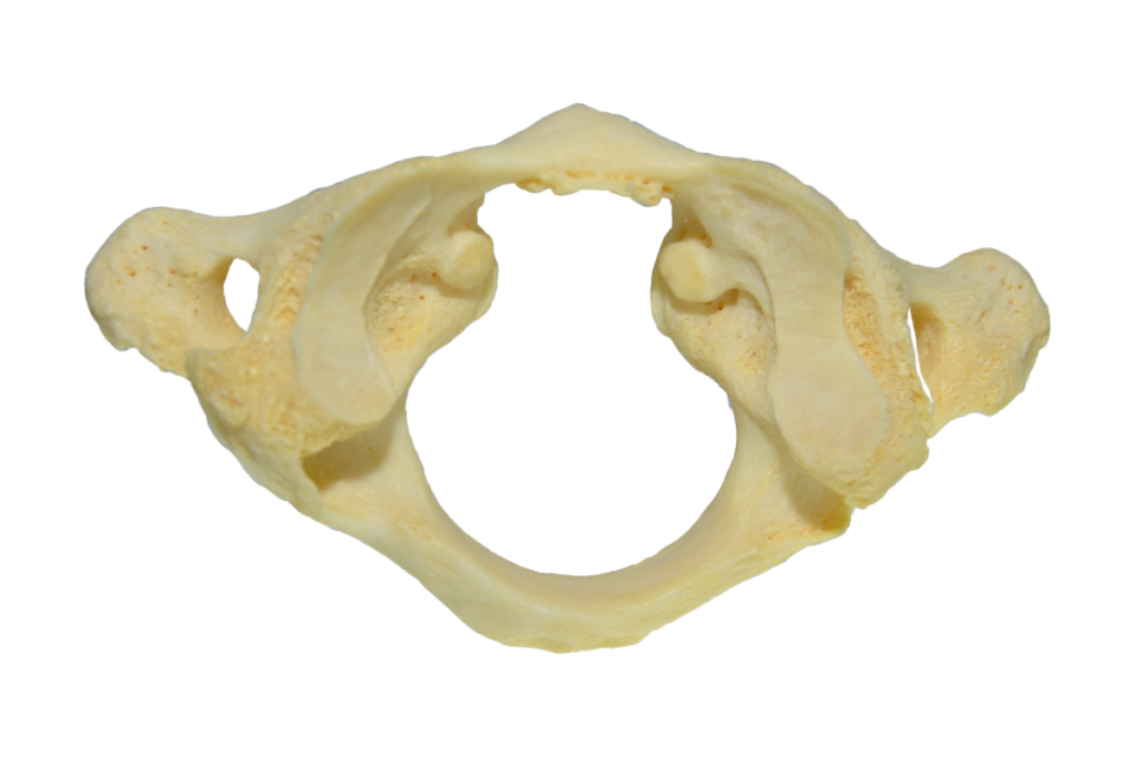 <p>Which vertebra is this and is it C1 or C2?</p>