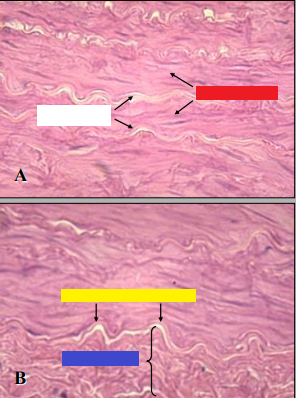 ano e2 + magnification