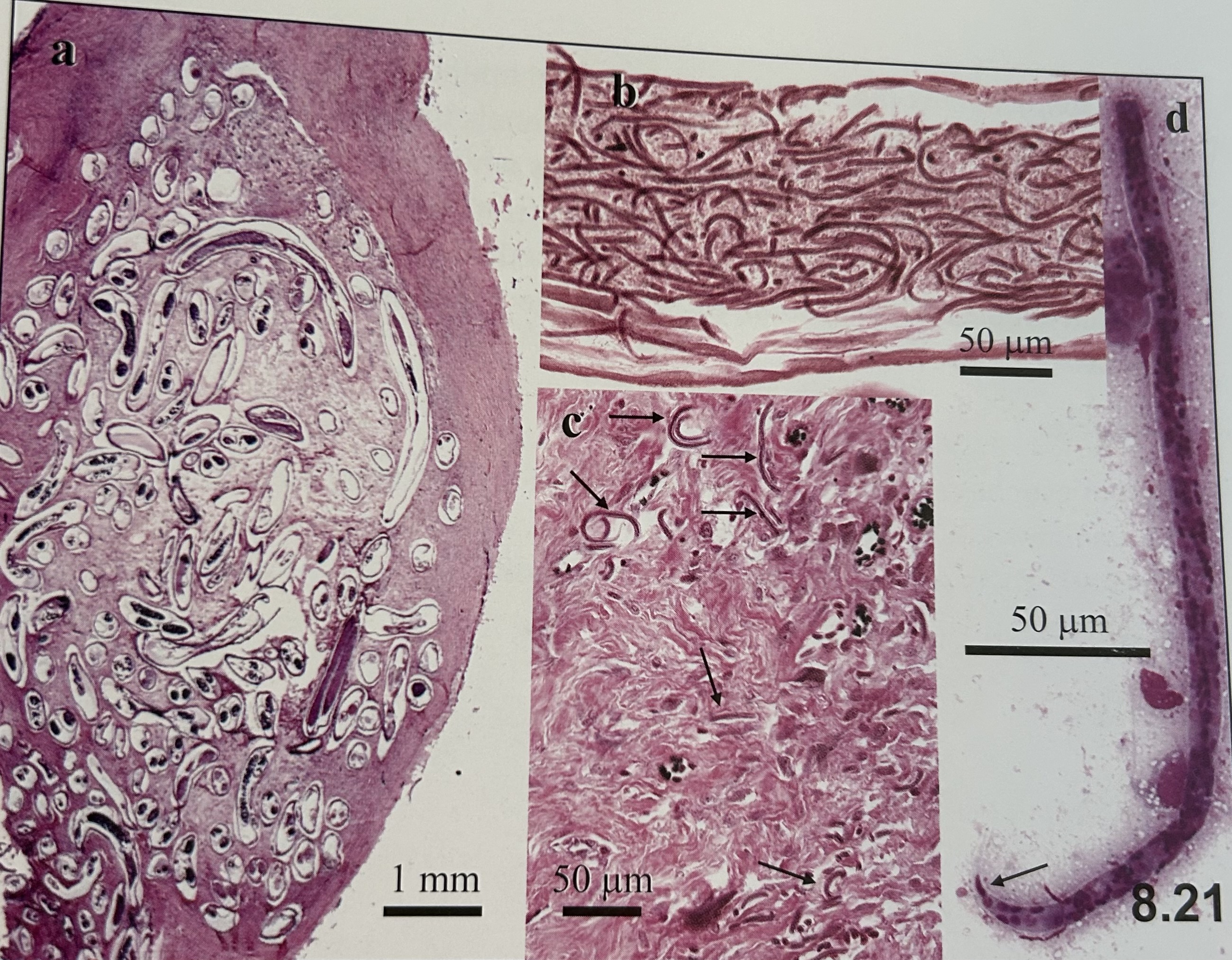 <p>characteristics of </p><p>Onchocerca volvulus (adult)?</p>