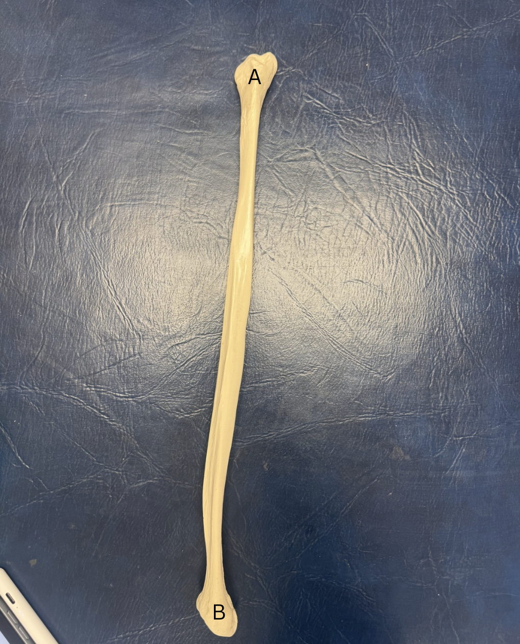 <p>Label A and B of this bone</p>