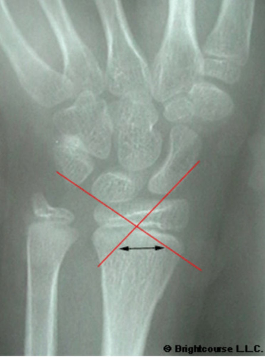 <p>What angle is being assessed in this image?</p>