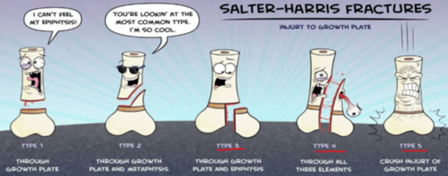 <p>- injury to growth plate (types 3-5; type 1-2 not likely to affect bc above growth plate)</p><p>- risk of growth compromise in peds</p>