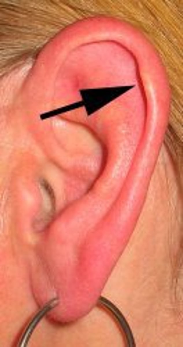 <p>In the pinna, curved part around the outside.</p>