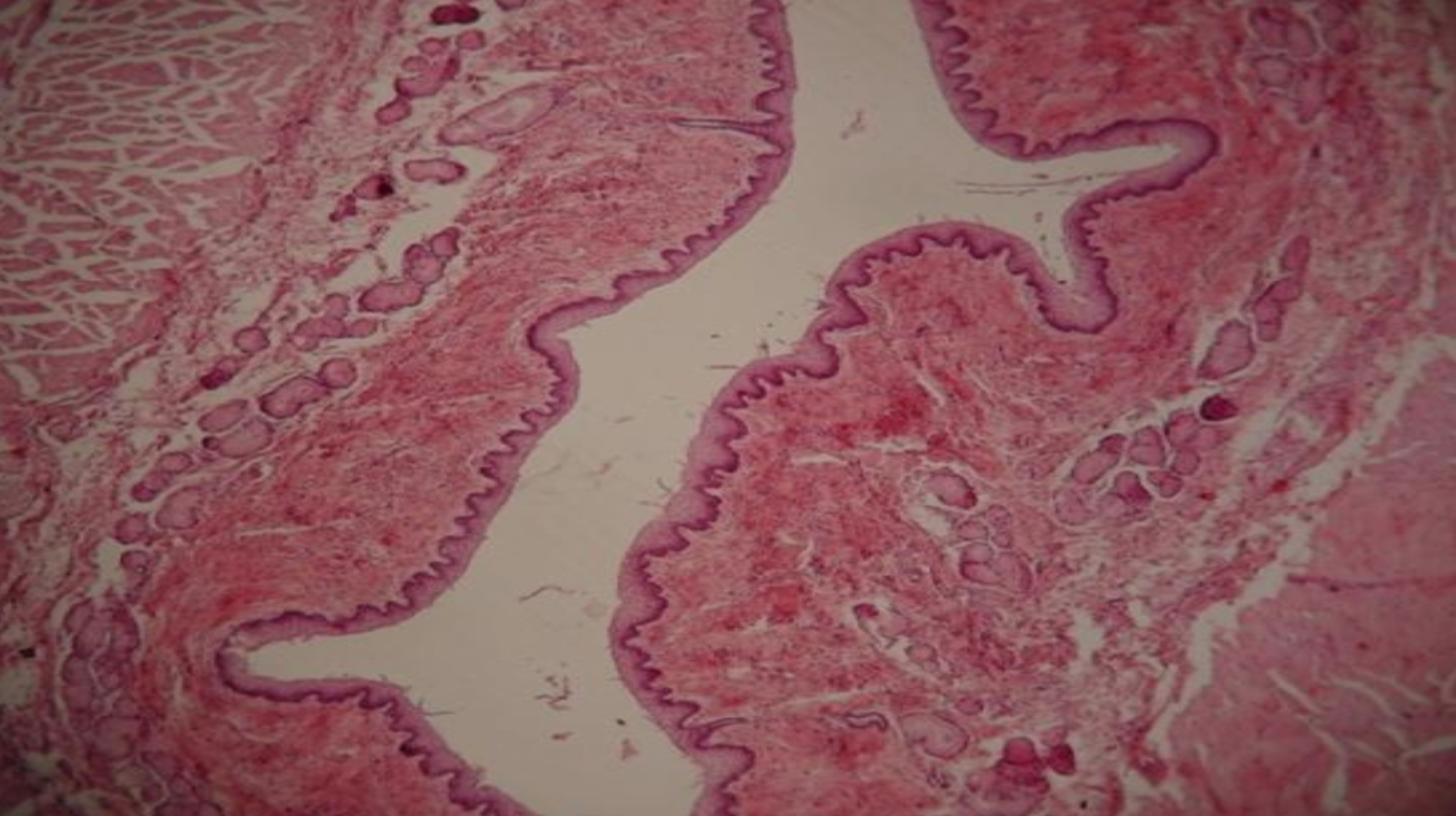 <p>Przełyk przekrój poprzeczny - esophagus transverse section</p>