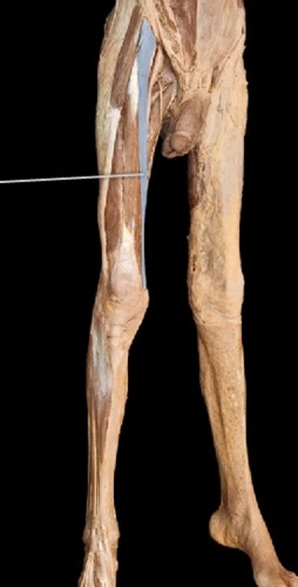 <p>What muscle is this?</p>