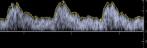 <p>larger</p><p>posterolateral (95%)</p><p>post to mastoid</p><p>NO extracranial branches</p><p>low resistance &amp; high diastolic flow</p>