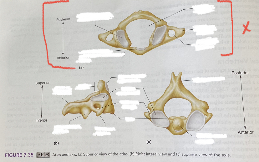 first cervical vertebra, unique ring-like vertebra