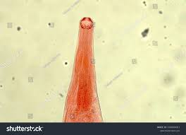 <p>(hint: teeth)</p>