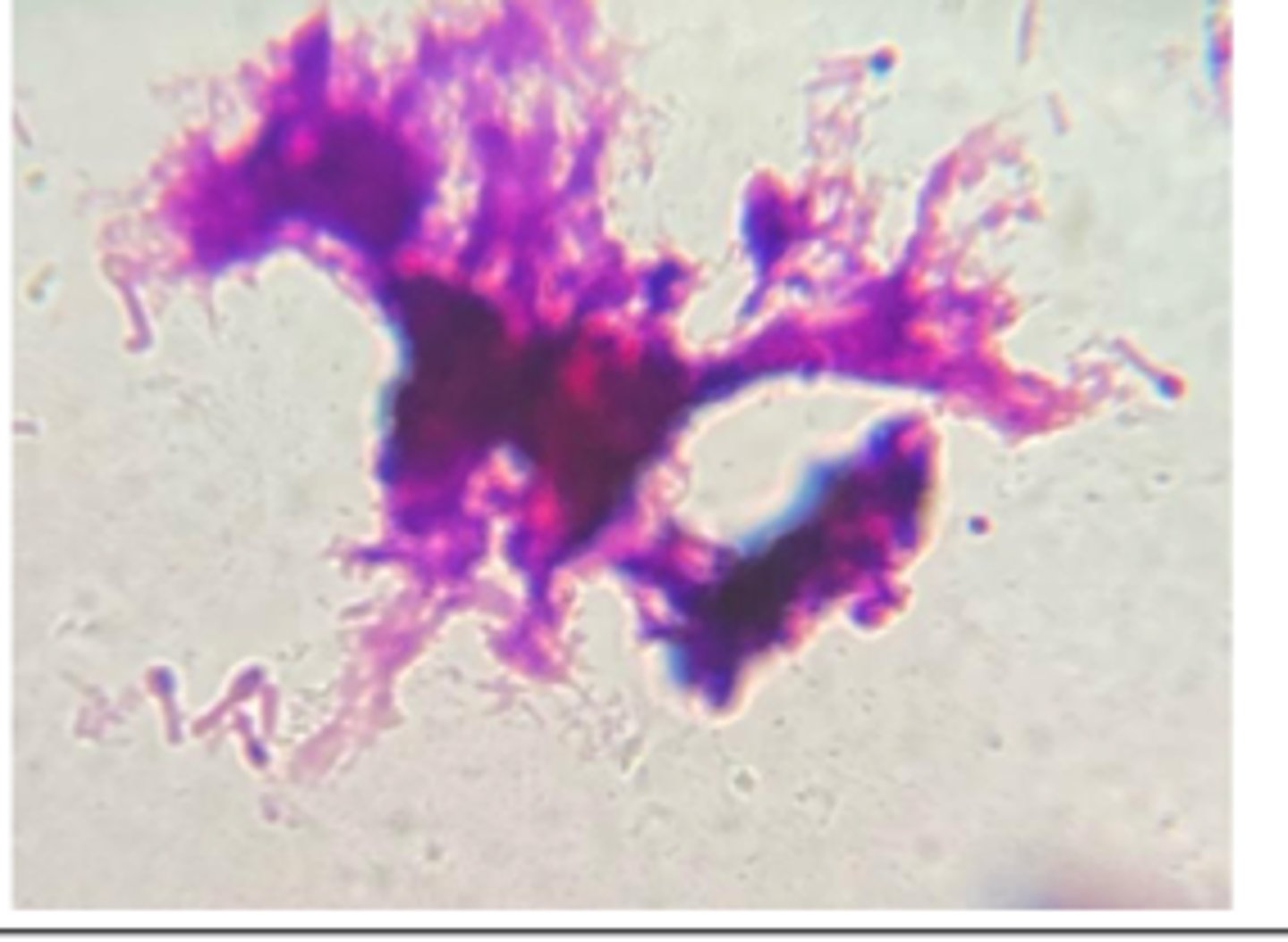 <p>A horse developed rigid extension of neck, back and limbs and an elevated tail head ("sawhorse stance").</p><p>Examination revealed a puncture wound on the lower left hind foot. A direct Gram-stained smear prepared from a wound aspirate is provided.</p><p>Presumptive Diagnosis</p>