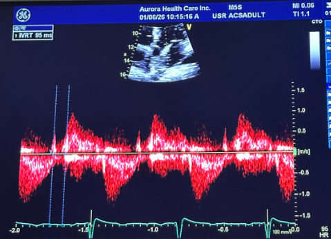 <p>what measurement is this for </p>