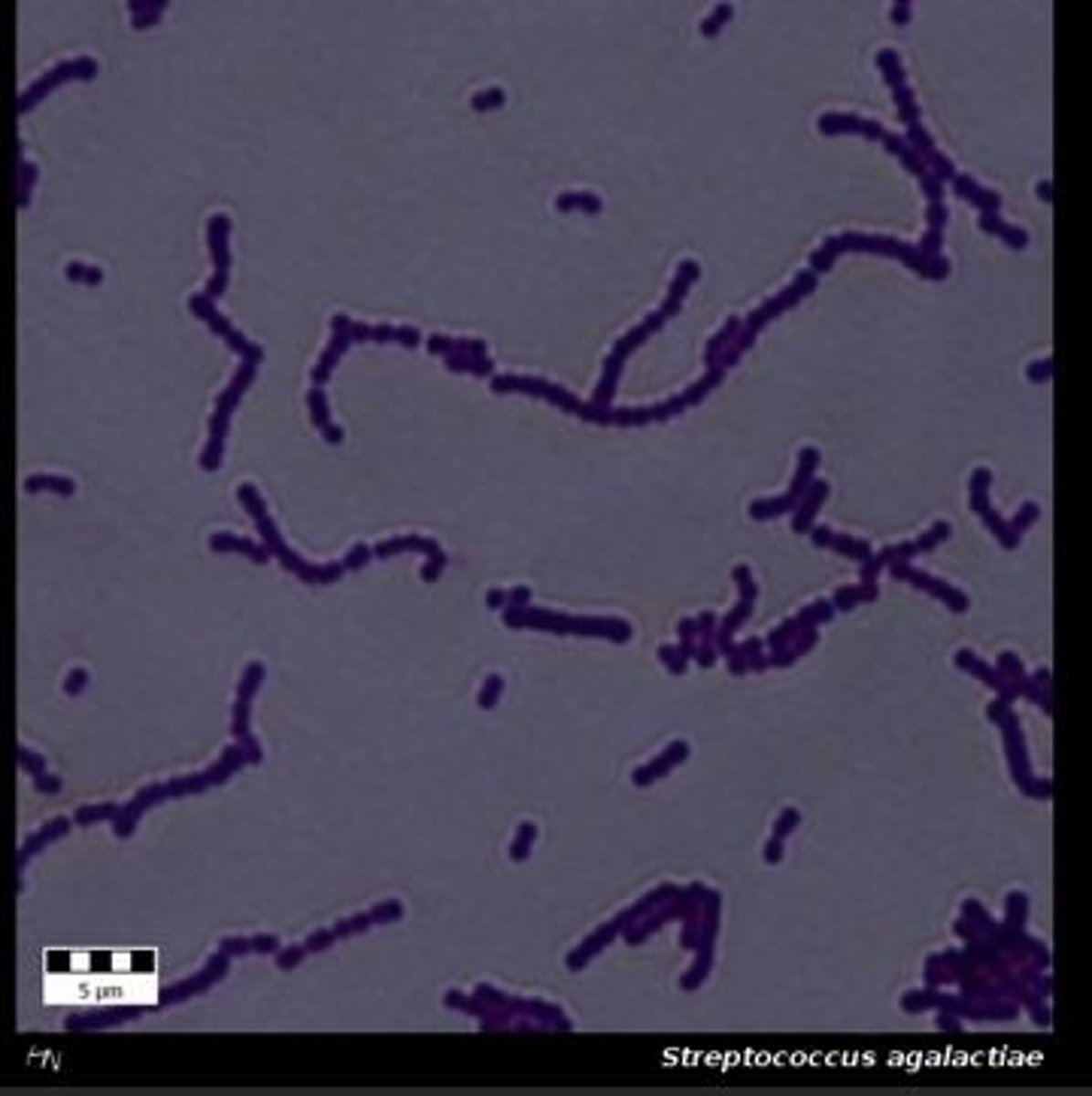 <p>Group B Streptococcus (GBS)</p><p>or Streptococcus agalactiae</p>