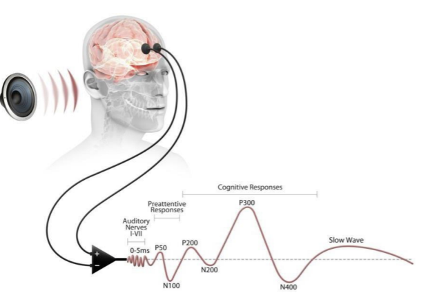 <p>ERPs use similar equipment to EEG (electrodes attached to the scalp) however, a stimulus is presented to a participant i.e. picture or sound, and the researcher looks for activity related to the stimulus and investigate how an EEG wave pattern changes in response to the stimulus. this change is an ERP</p><p>the stimulus is presented hundreds of times and an average response is graphed. this is statistical averaging technique, and it reduces an extraneous brain activity which makes the specific response to the stimulus stand out</p><p>research has revealed many different forms of ERP and how, for example, they are linked to cognitive processes such as attention and perception. for example, the image shows the type of brain waves triggered by an auditory stimulus</p>